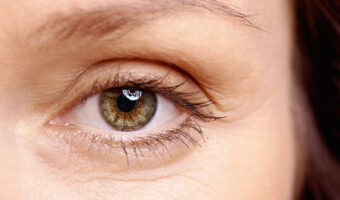 Can You Catch COVID-19 Through Your Eyes?