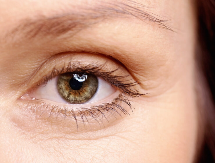 Can You Catch COVID-19 Through Your Eyes?